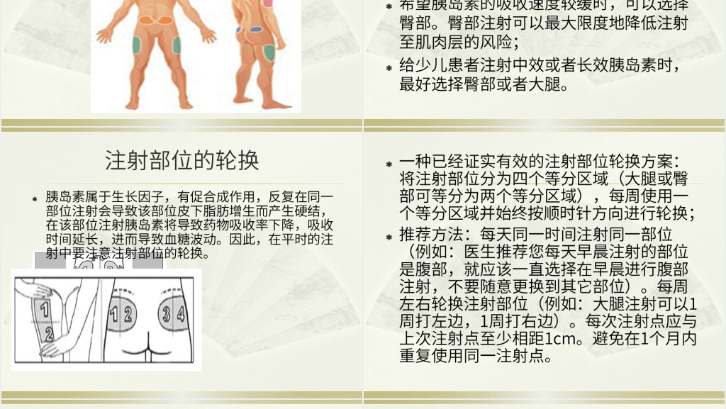 胰岛素的种类及用法PPT 胰岛素的种类及用法PPT