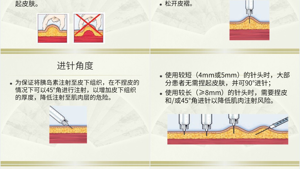 胰岛素的种类及用法PPT 胰岛素的种类及用法PPT