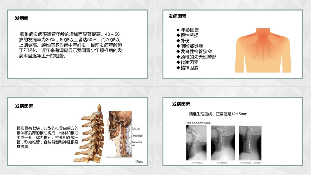 颈椎病发病原因及治疗PPT模板 颈椎病发病原因及治疗PPT模板