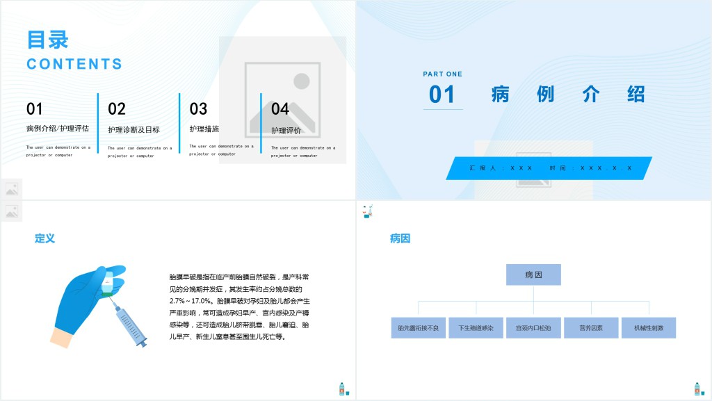 胎膜早破病人的护理常规措施PPT模板