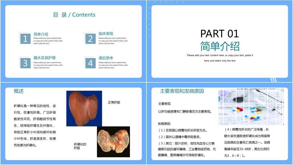 肝硬化病人的腹水护理措施内容PPT模板 肝硬化病人的腹水护理措施内容PPT模板