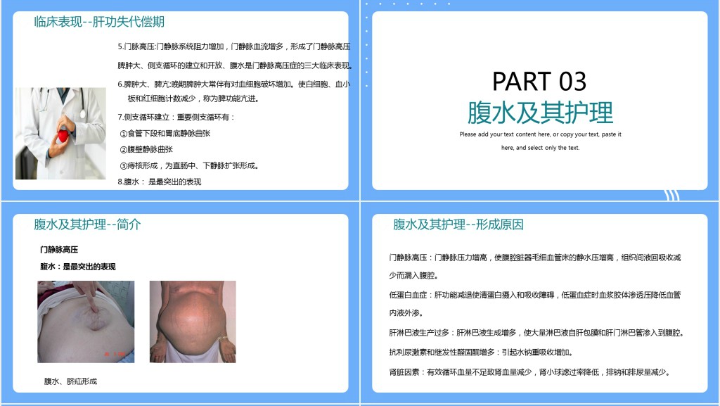 肝硬化病人的腹水护理措施内容PPT模板 肝硬化病人的腹水护理措施内容PPT模板