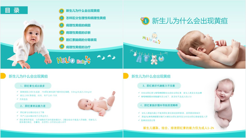 新生儿黄疸治疗方法PPT模板 新生儿黄疸治疗方法PPT模板