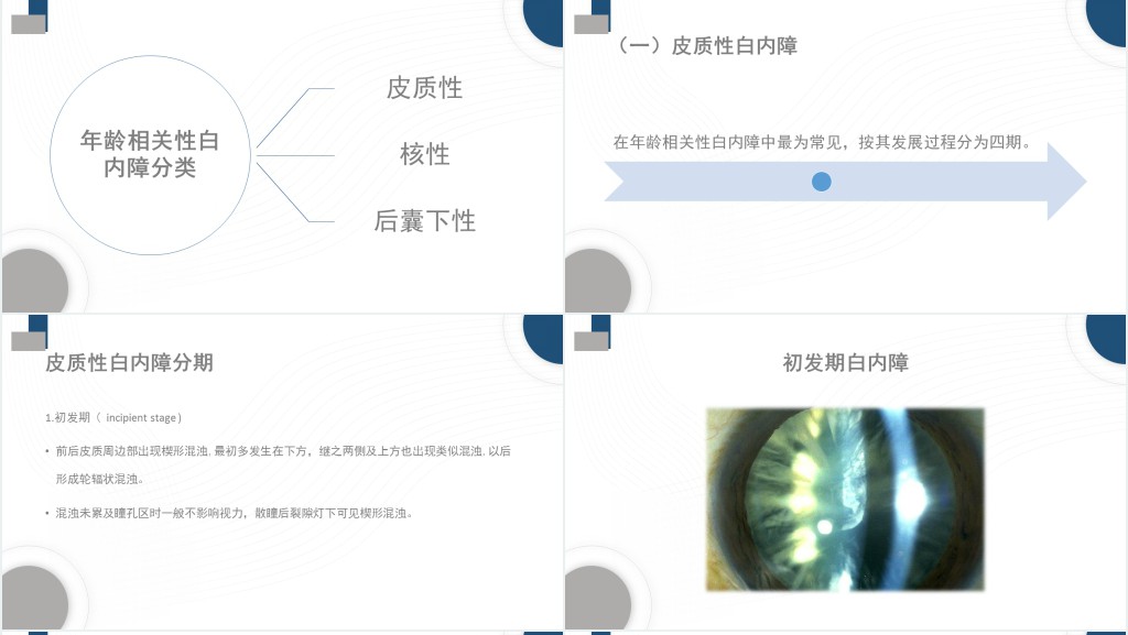 白内障护理常规措施PPT模板 白内障护理常规措施PPT模板
