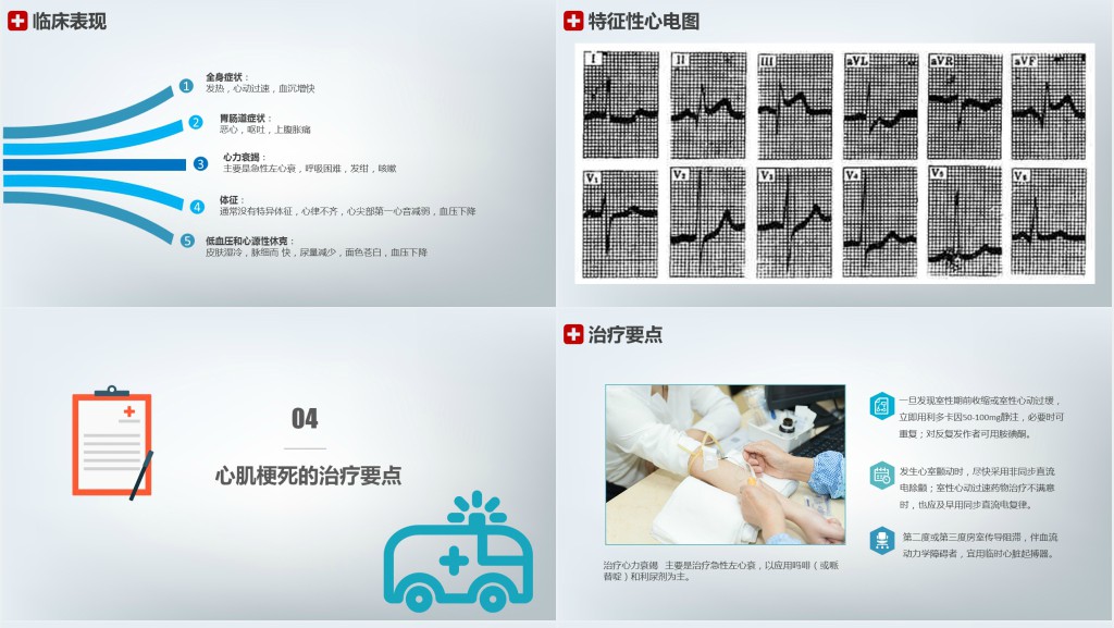 急性心梗患者护理查房PPT模板 急性心梗患者护理查房PPT模板