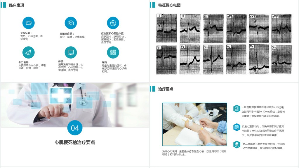 急性心梗患者护理查房护理培训PPT模板 急性心梗患者护理查房护理培训PPT模板