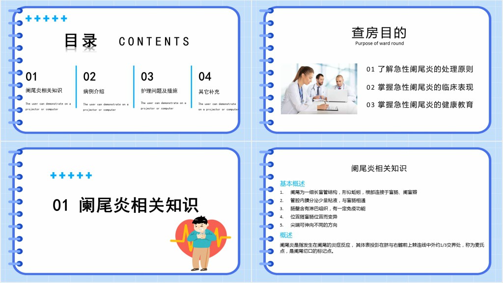 急性阑尾炎的教学护理查房PPT模板 急性阑尾炎的教学护理查房PPT模板
