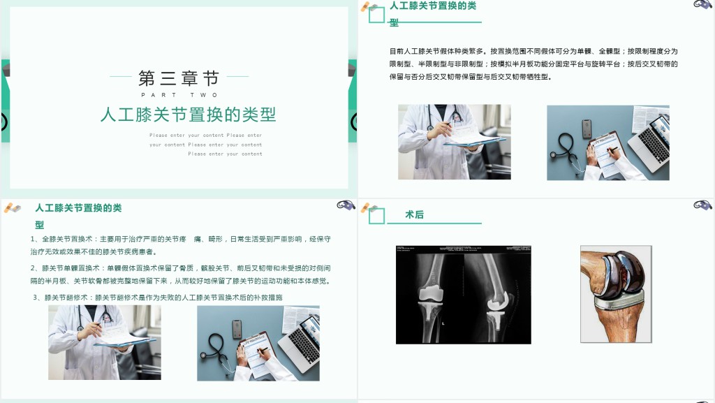 膝关节置换术后护理查房讲解PPT模板 膝关节置换术后护理查房讲解PPT模板