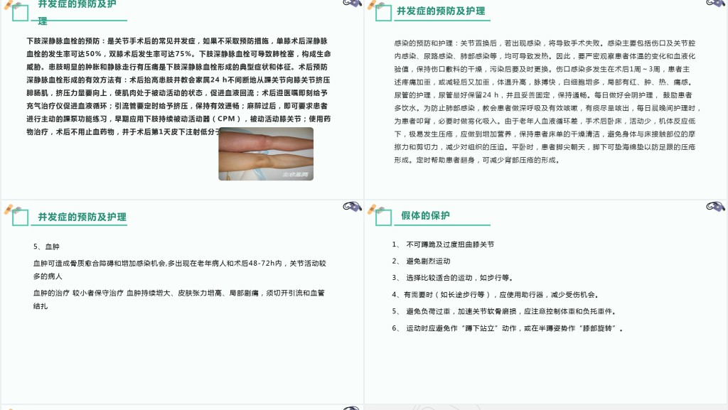 膝关节置换术后护理查房讲解PPT模板 膝关节置换术后护理查房讲解PPT模板