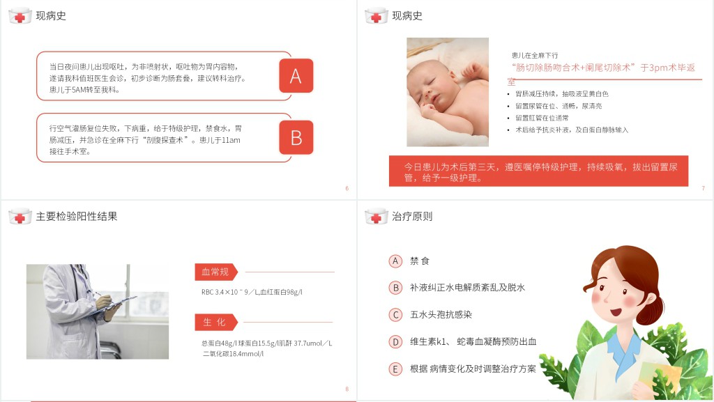 小儿肠套叠护理查房范本PPT模板 小儿肠套叠护理查房范本PPT模板