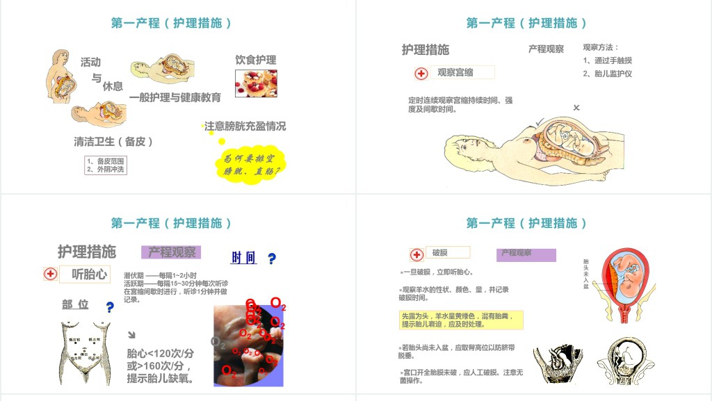 分娩期妇女的护理讲课PPT课件 分娩期妇女的护理讲课PPT课件