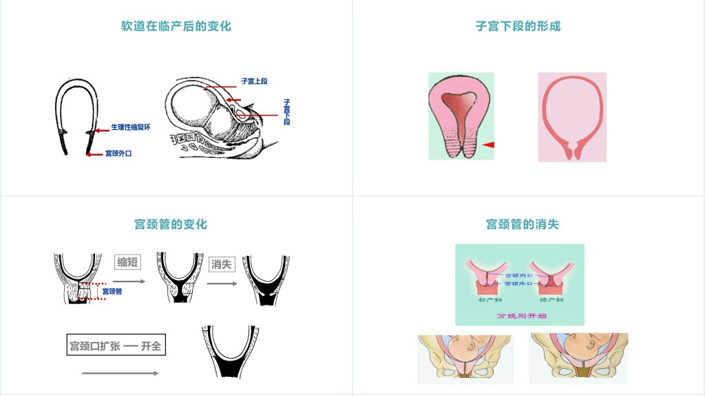 分娩期妇女的护理讲课PPT课件 分娩期妇女的护理讲课PPT课件