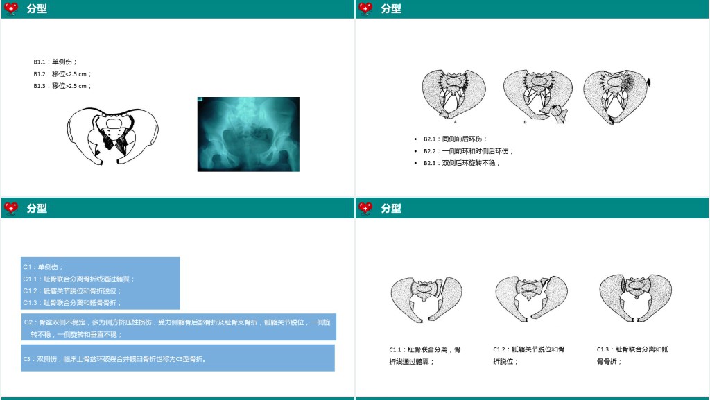 骨盆骨折病人护理查房PPT模板 骨盆骨折病人护理查房PPT模板