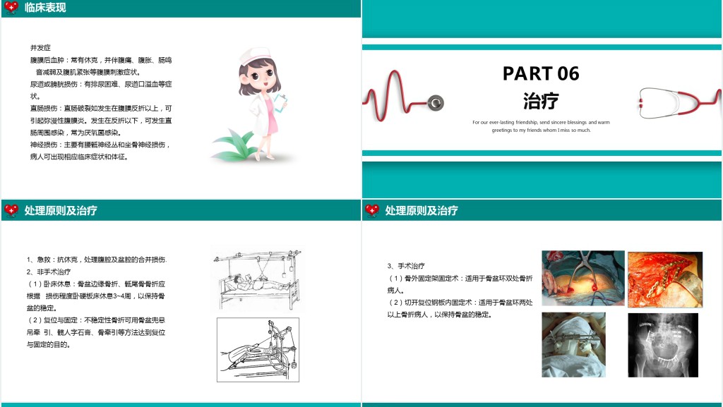骨盆骨折病人护理查房PPT模板 骨盆骨折病人护理查房PPT模板