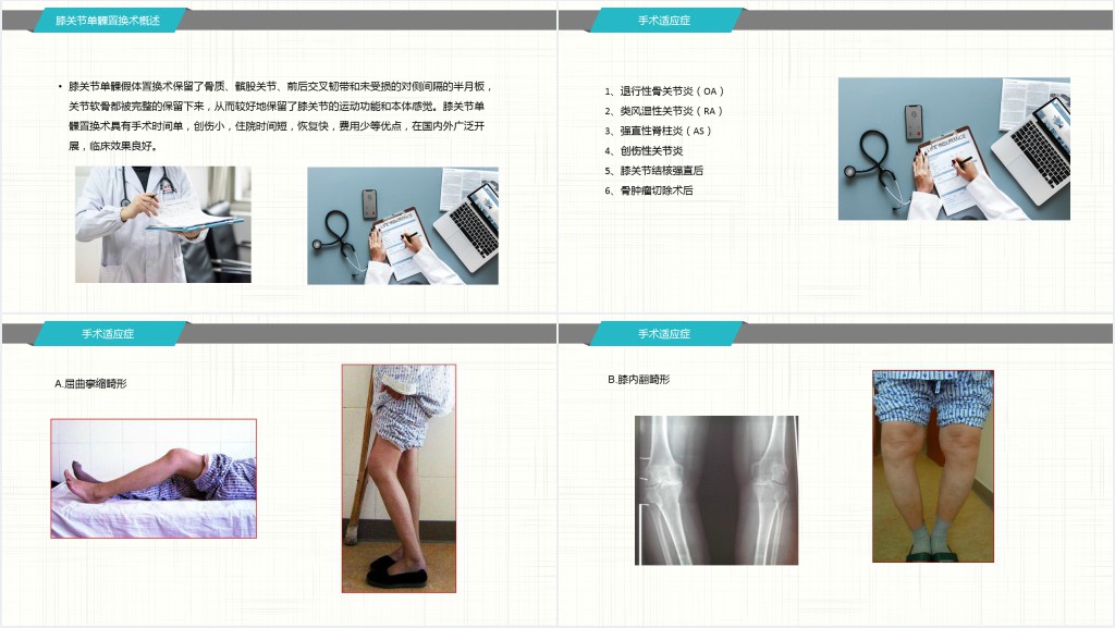 膝关节置换术后护理查房范文PPT模板 膝关节置换术后护理查房范文PPT模板