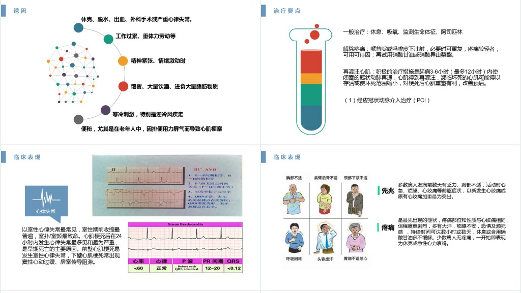 急性心肌梗死护理查房文档PPT课件 急性心肌梗死护理查房文档PPT课件