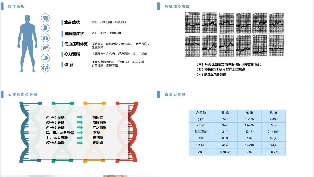 急性心肌梗死护理查房文档PPT课件 急性心肌梗死护理查房文档PPT课件