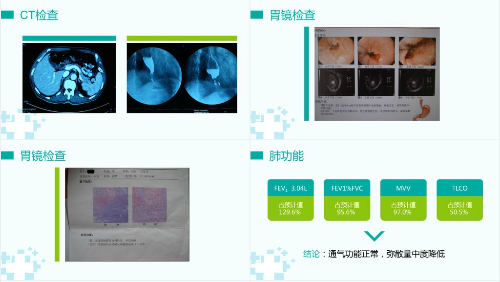 胸外科病例汇报PPT 胸外科病例汇报PPT