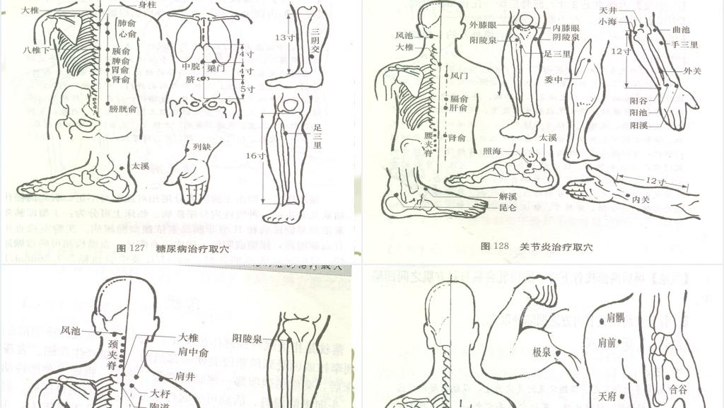 中医常见病推拿按摩治疗PPT模板 中医常见病推拿按摩治疗PPT模板