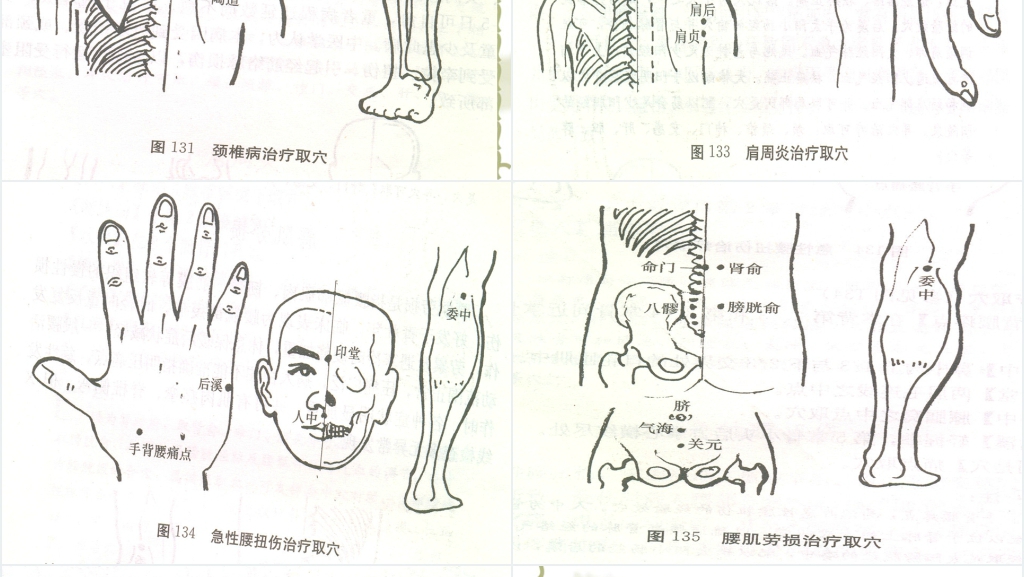 中医常见病推拿按摩治疗PPT模板 中医常见病推拿按摩治疗PPT模板