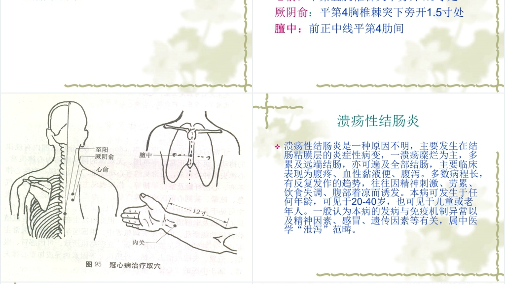 中医常见病推拿按摩治疗PPT模板 中医常见病推拿按摩治疗PPT模板