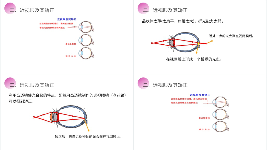 人教版八年级初二物理上册《眼睛和眼镜》PPT课件 人教版八年级初二物理上册《眼睛和眼镜》PPT课件