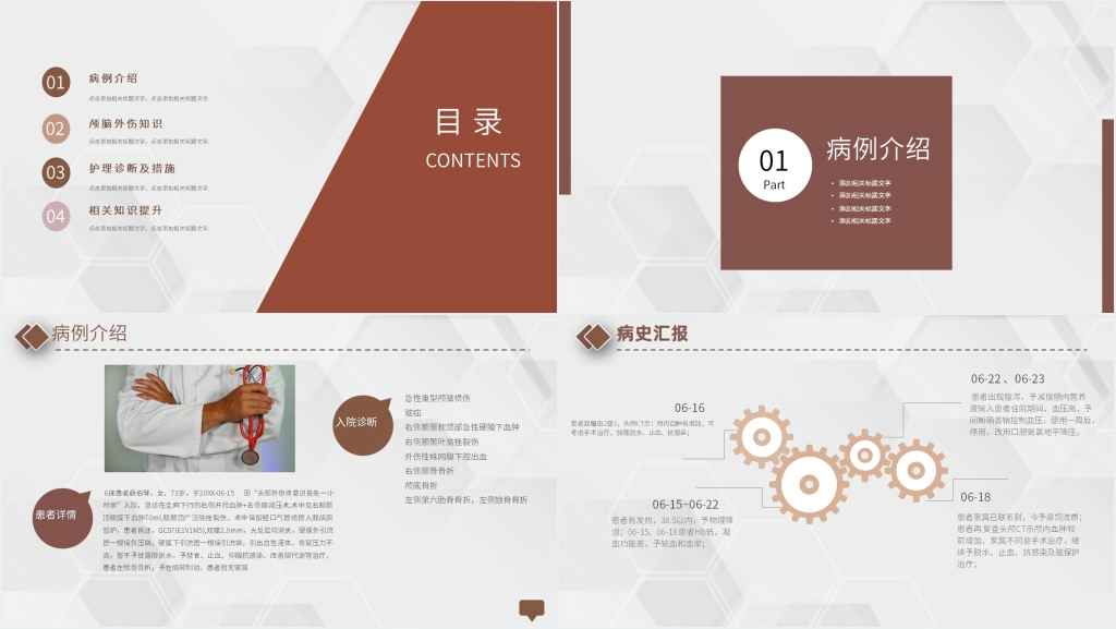 重度颅脑外伤查房护理PPT范文 重度颅脑外伤查房护理PPT范文