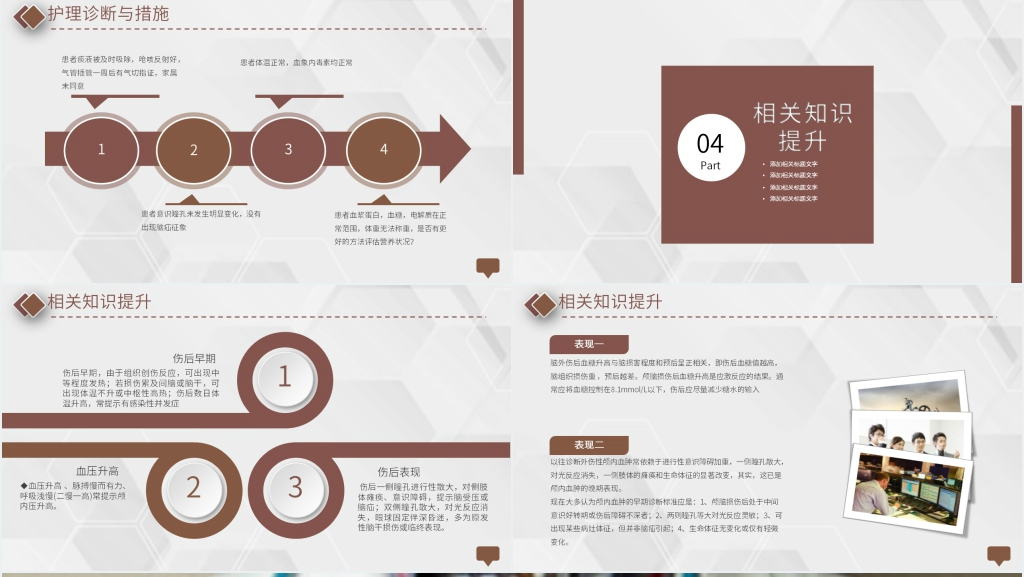 重度颅脑外伤查房护理PPT范文 重度颅脑外伤查房护理PPT范文