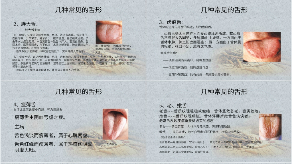中医舌诊完全图解PPT课件 中医舌诊完全图解PPT课件