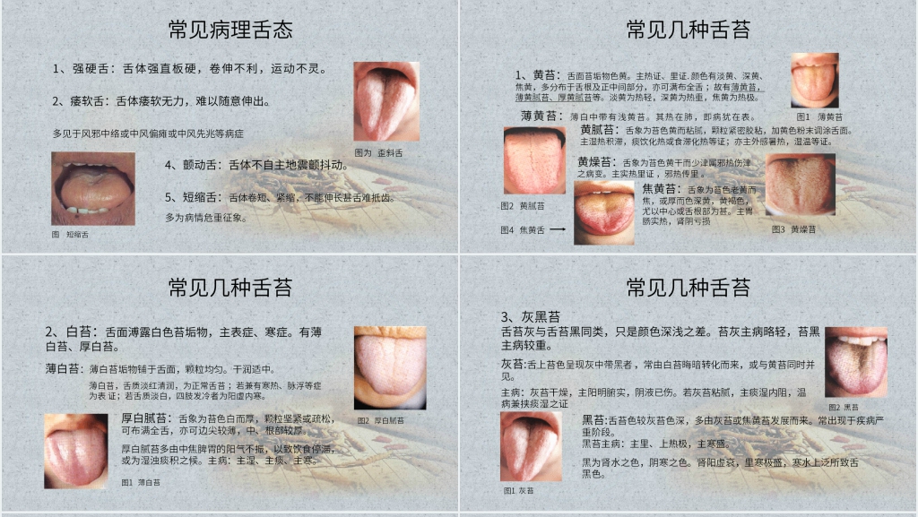 中医舌诊完全图解PPT课件 中医舌诊完全图解PPT课件