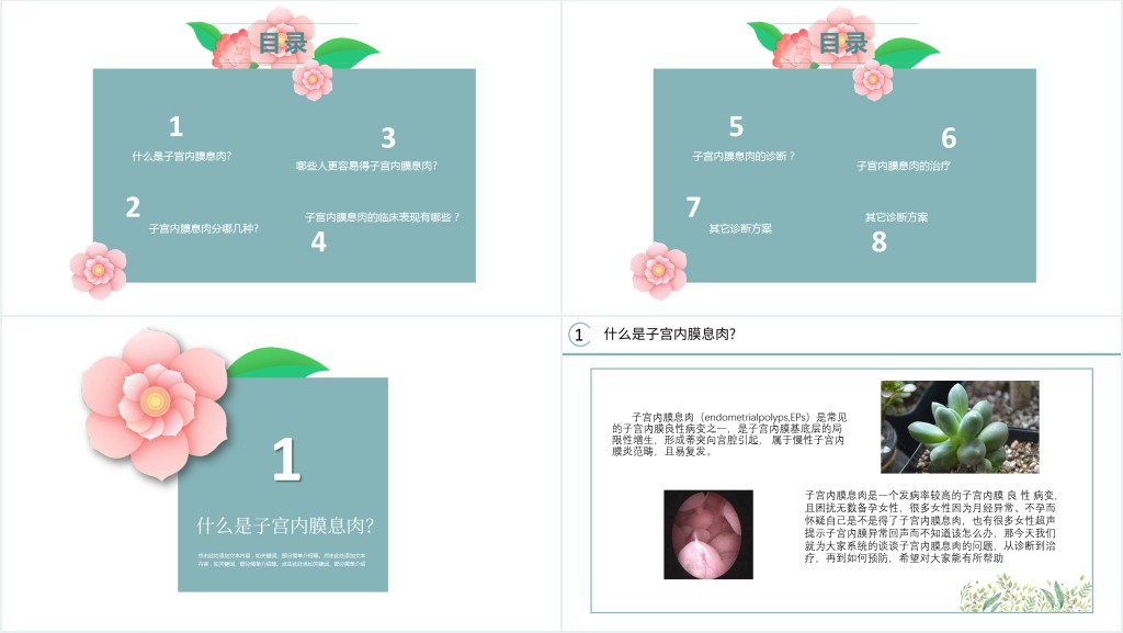 子宫内膜息肉PPT清新创意医学医疗类PPT模板