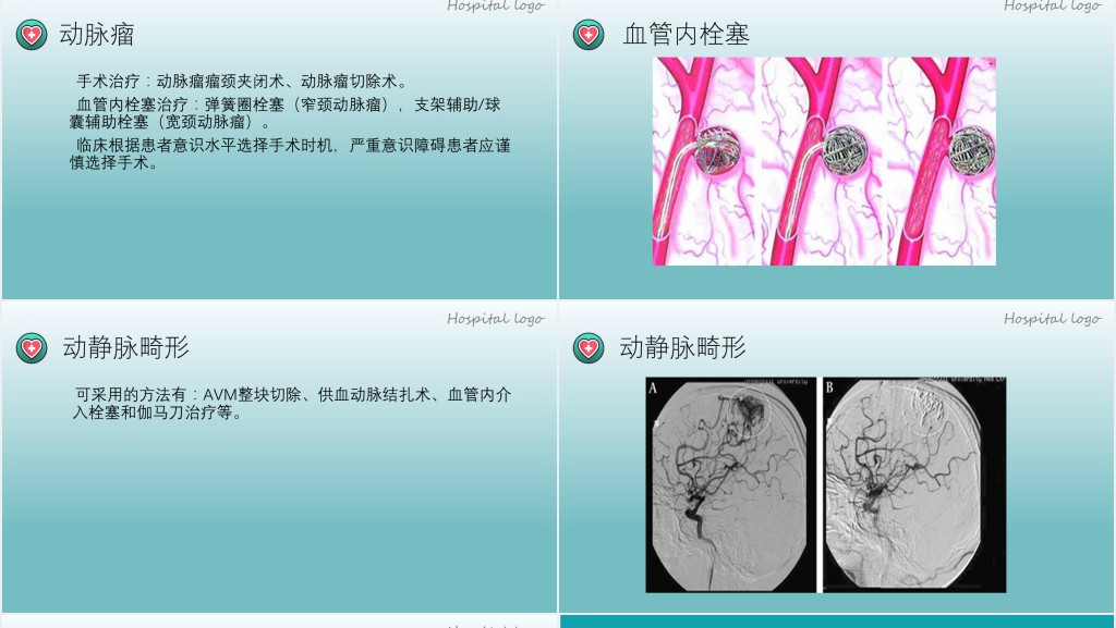 蛛网膜下腔出血PPT创意简约医疗教学各种疾病医理PPT模板