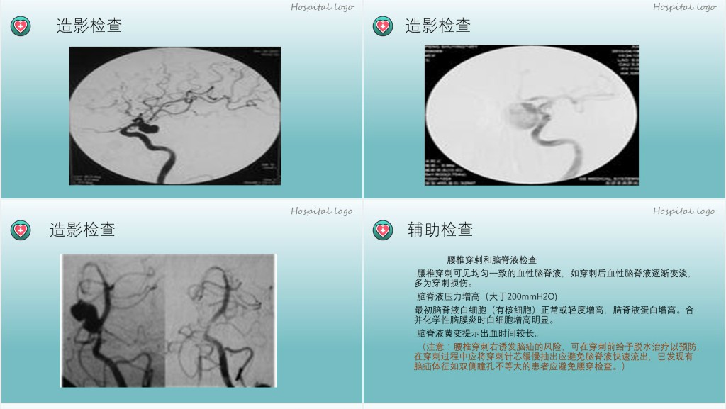 蛛网膜下腔出血PPT创意简约医疗教学各种疾病医理PPT模板