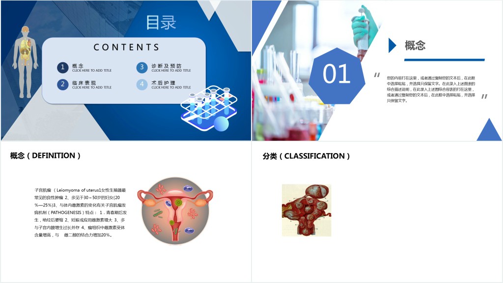 子宫肌瘤PPT医疗教学疾病医理类PPT模板