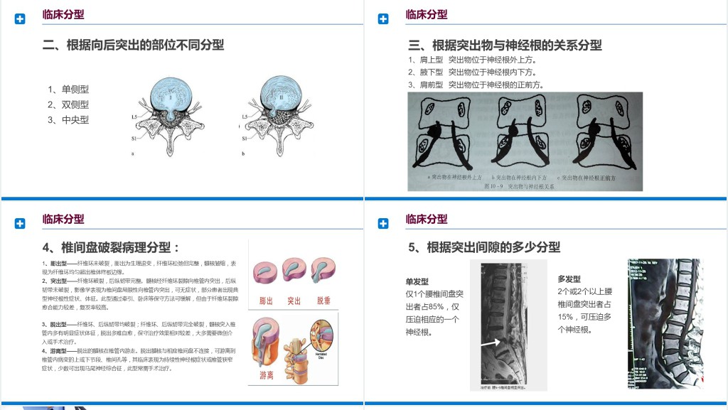 腰间盘突出症诊断与治疗PPT模板 腰间盘突出症诊断与治疗PPT模板