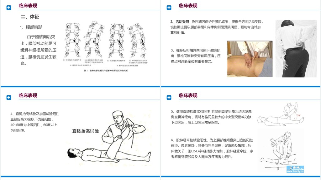 腰间盘突出症诊断与治疗PPT模板 腰间盘突出症诊断与治疗PPT模板