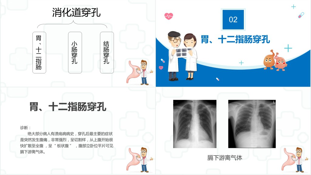 消化道穿孔疾病知识PPT课件