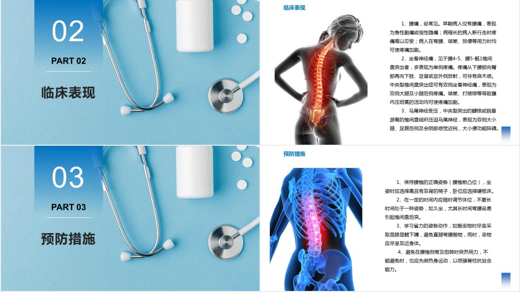 腰椎间盘突出的健康教育PPT课件