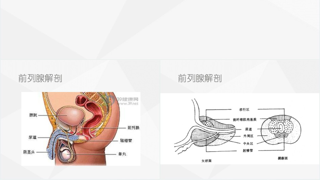 前列腺癌图文PPT课件 前列腺癌图文PPT课件