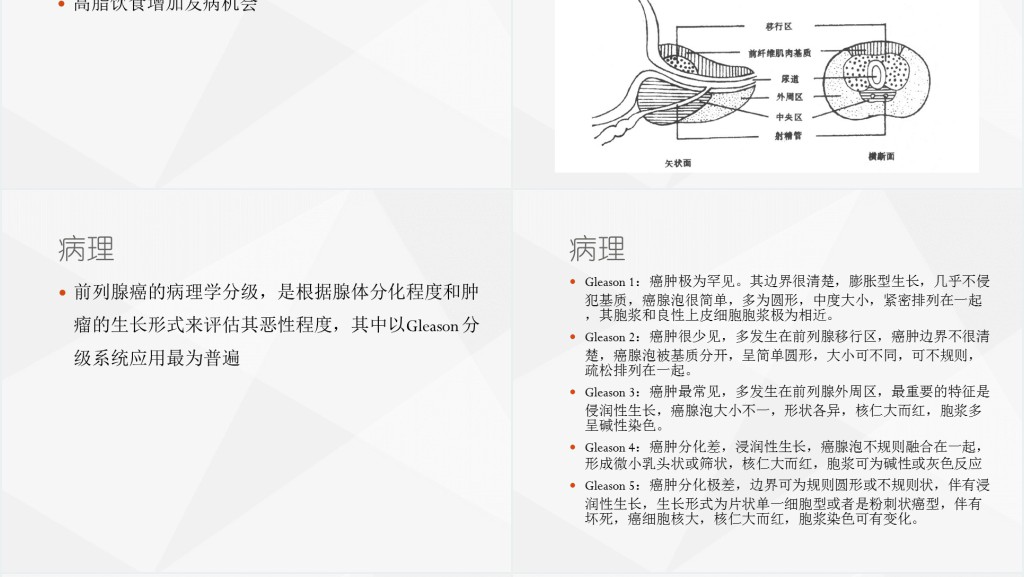 前列腺癌图文PPT课件 前列腺癌图文PPT课件