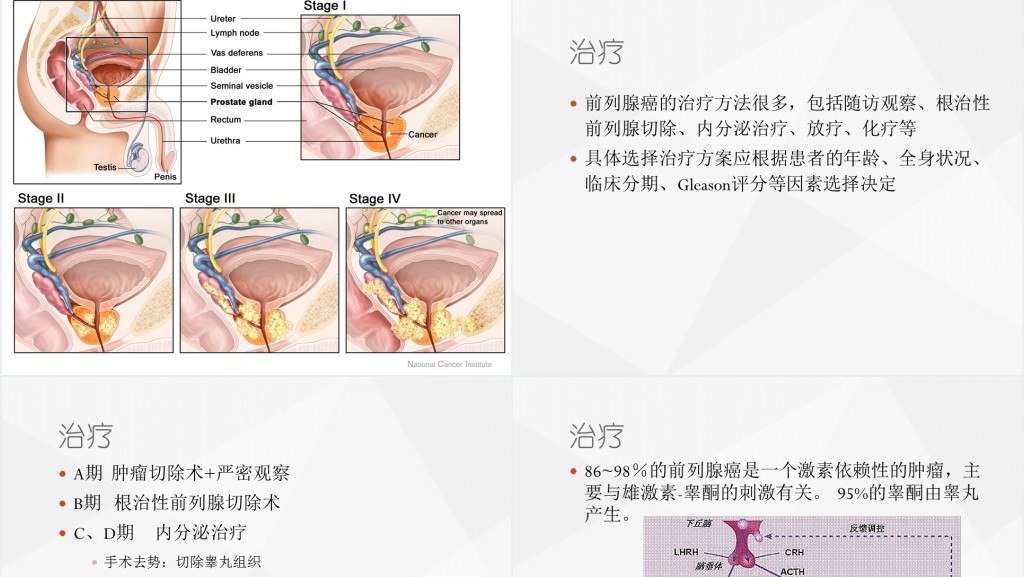 前列腺癌图文PPT课件 前列腺癌图文PPT课件
