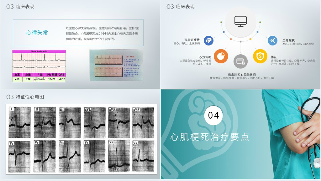 急性心梗病人的护理PPT课件 急性心梗病人的护理PPT课件