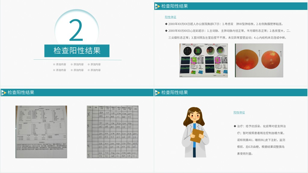 糖尿病合并肺结核护理诊断PPT 糖尿病合并肺结核护理诊断PPT